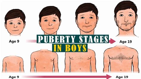 hairy teen|Stages of Puberty Explained in Pictures